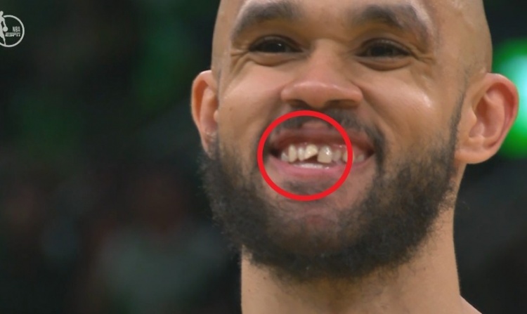 小白回忆总决赛门牙受伤：随后命中三分成最美时刻